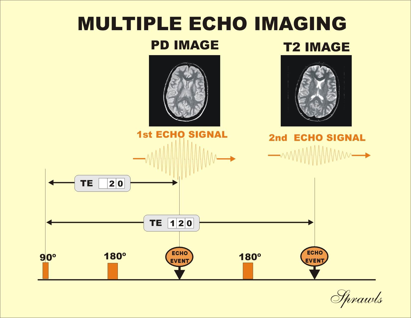 Resonance Imaging